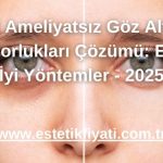 3 Ameliyatsız Göz Altı Morlukları Çözümü: En İyi Yöntemler - 2025