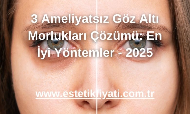 3 Ameliyatsız Göz Altı Morlukları Çözümü: En İyi Yöntemler - 2025