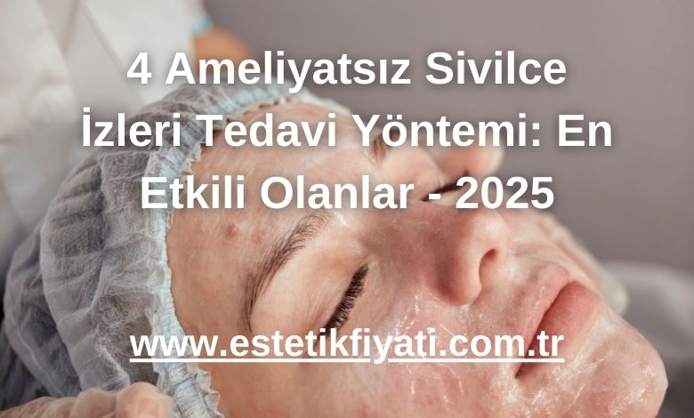 4 Ameliyatsız Sivilce İzleri Tedavi Yöntemi: En Etkili Olanlar - 2025