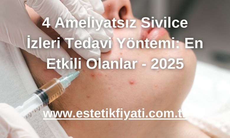 4 Ameliyatsız Sivilce İzleri Tedavi Yöntemi: En Etkili Olanlar - 2025