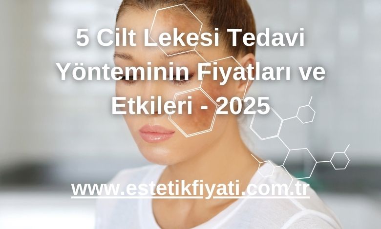 5 Cilt Lekesi Tedavi Yönteminin Fiyatları ve Etkileri - 2025