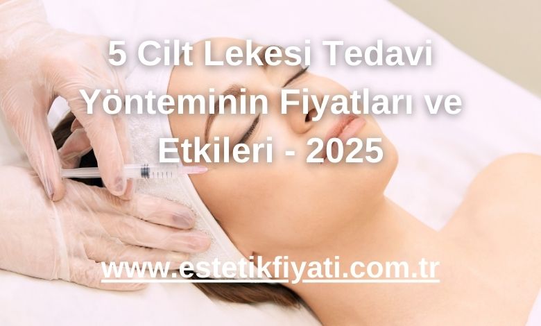 5 Cilt Lekesi Tedavi Yönteminin Fiyatları ve Etkileri - 2025