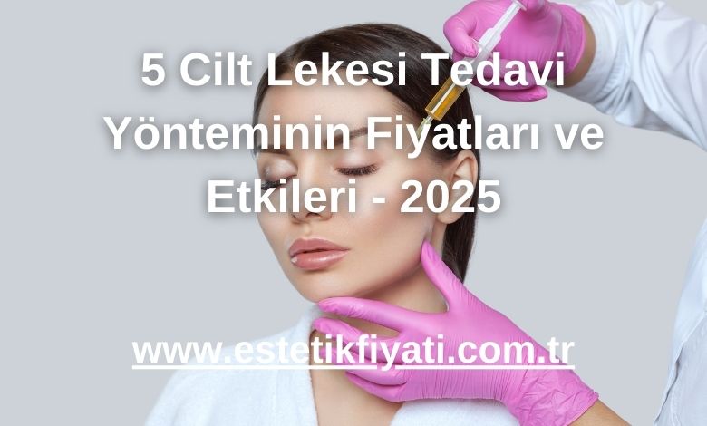 5 Cilt Lekesi Tedavi Yönteminin Fiyatları ve Etkileri - 2025