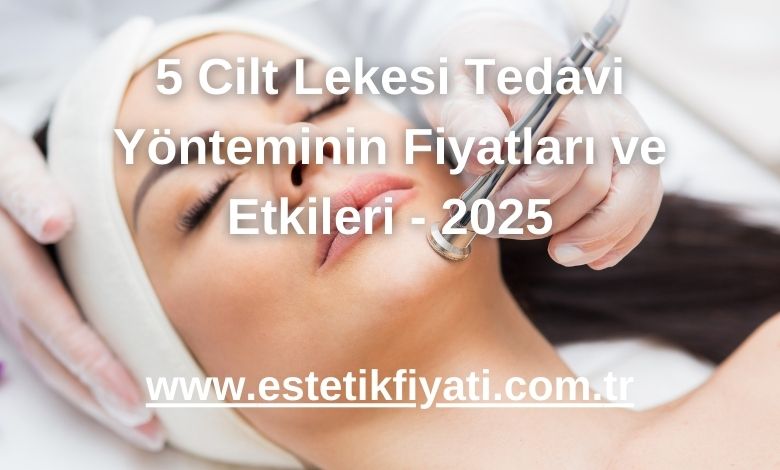 5 Cilt Lekesi Tedavi Yönteminin Fiyatları ve Etkileri - 2025