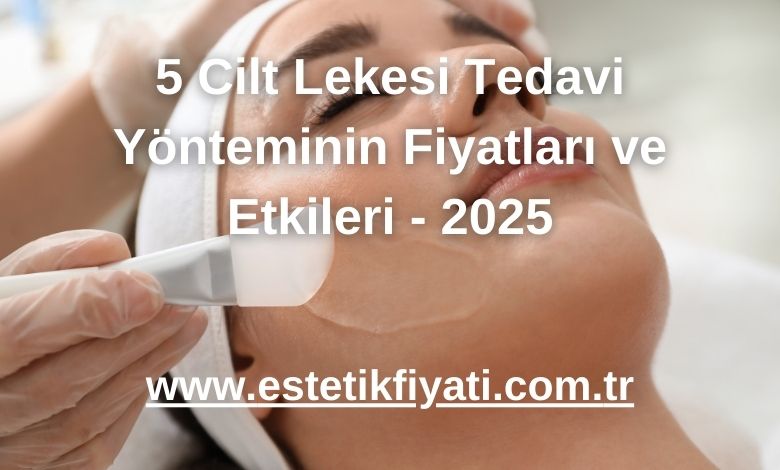 5 Cilt Lekesi Tedavi Yönteminin Fiyatları ve Etkileri - 2025