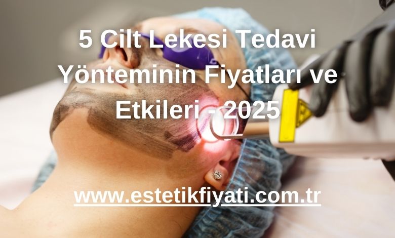 5 Cilt Lekesi Tedavi Yönteminin Fiyatları ve Etkileri - 2025
